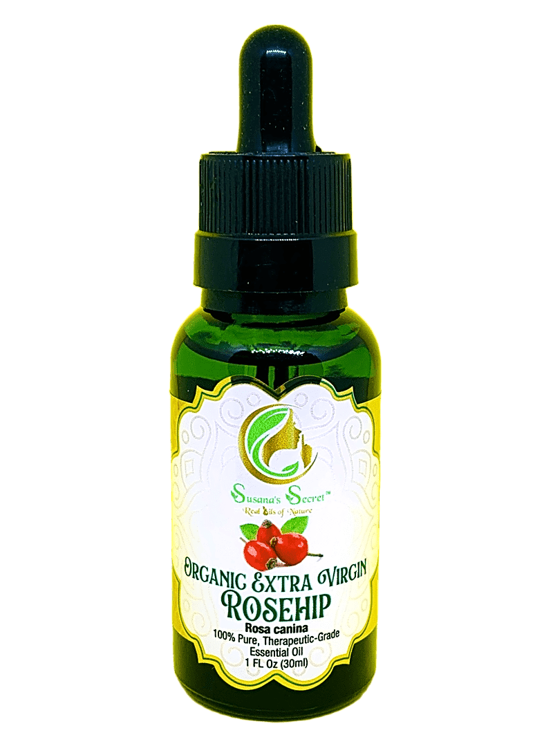 ROSEHIP Organic Extra Virgin Cold Pressed Oil- 100% PURE, Therapeutic-Grade, 1 FL Oz/30 ml- Glass bottle w/dropper pipette